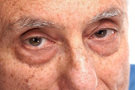 预防白内障的措施有哪些?(这四招预防老年性白内障发现)