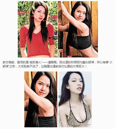 女星隆胸前后对比照片图