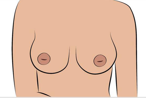 乳头形状有几种图片