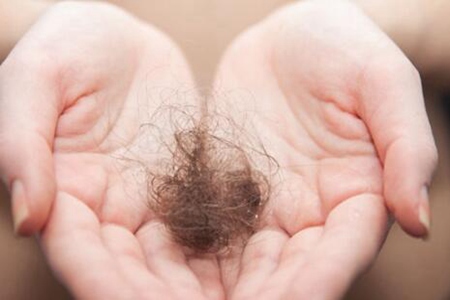 脱发严重是什么原因引起的?这五个原因值得重视要改善