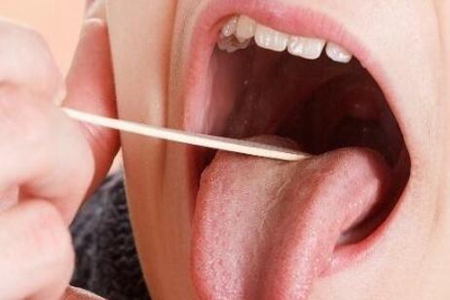 扁桃体发炎怎么办最简单的方法?这五个方法缓解发炎的痛苦