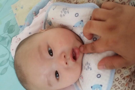 初生宝宝长马牙怎么办?宝宝长马牙原因