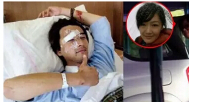 胡歌车祸后怎么整容的