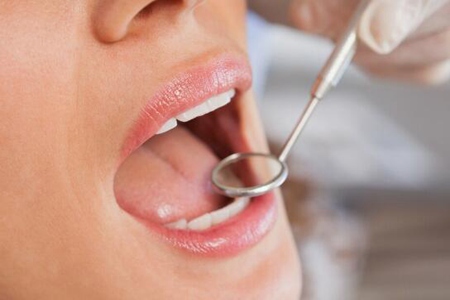 口腔溃疡的治疗方法,治疗溃疡只需要4点做好