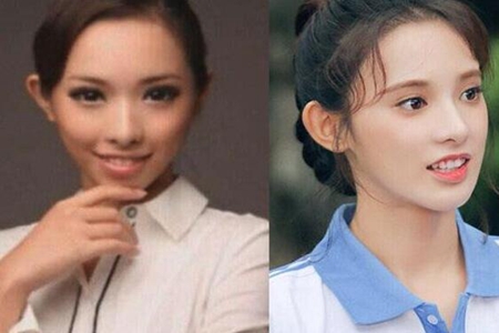 《东宫》人气彭小苒整容,彭小苒整容前后对比照