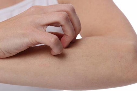 浑身瘙痒是大病的前兆？这五个疾病的警示信号不要不在乎