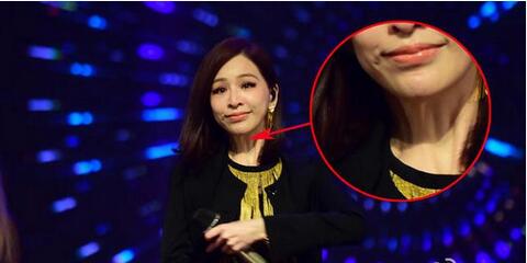 整容失败的明星谁最惨