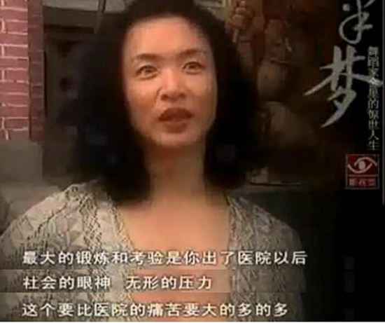 金星为什么要变性手术男变女过程