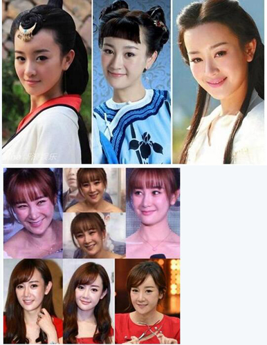 整容失败的明星谁最惨