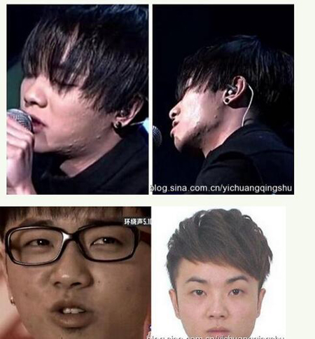 中国卸妆后最丑女明星烂脸爆痘照