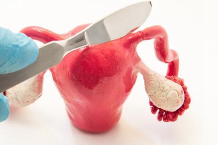 宫颈糜烂的原因有哪些？这五个原因要重视早留意早治疗