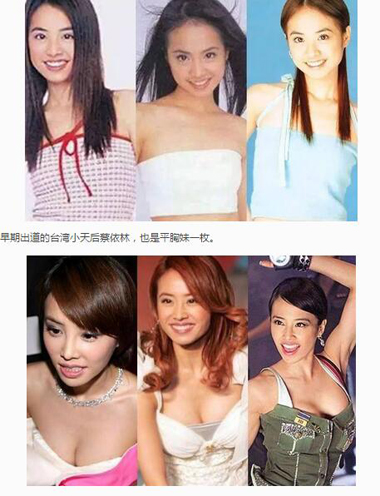 女星隆胸前后对比照片图