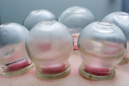 拔火罐的好处和坏处,拔火罐的这3点知识要知道