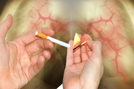 中风的原因是什么引起的?这五个因素造成得要及时改掉