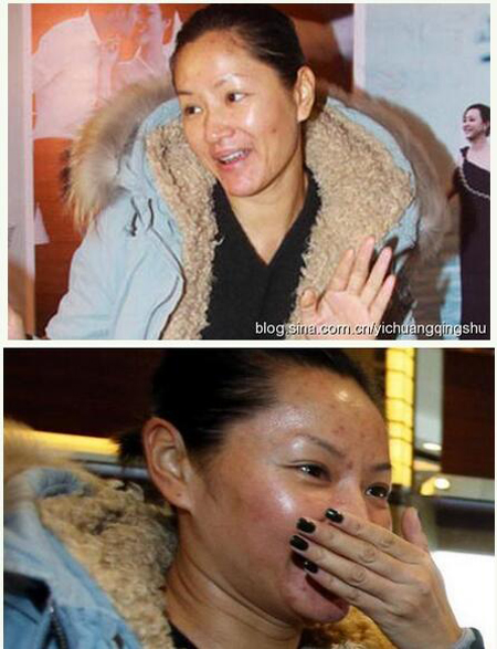中国卸妆后最丑女明星烂脸爆痘照