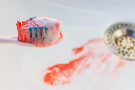 牙龈出血是什么原因？这三个原因引发不容忽视要治疗