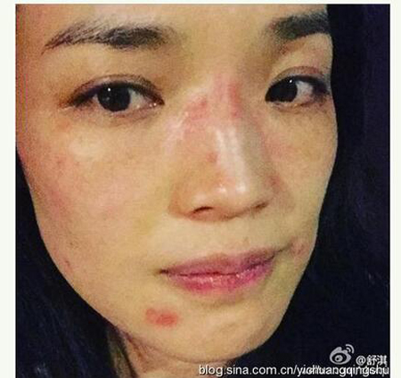 中国卸妆后最丑女明星烂脸爆痘照