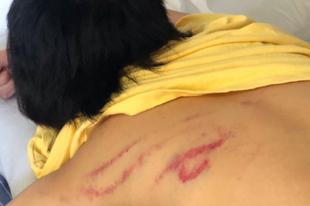 渣男张嫮目家暴曝光,掰断食指还强迫发生性关系