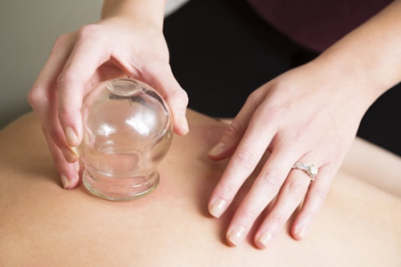 拔罐能去除体内湿气吗？这五种拔罐的好处和坏处
