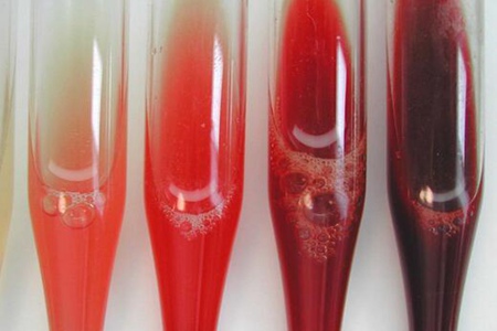 尿血是什么原因？这五个因素引发赶快对症下药