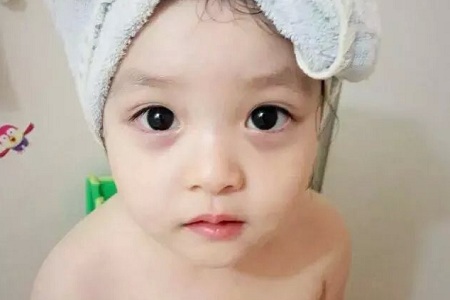 小孩为何会患鼻炎？关键身体有小情绪