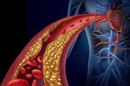 三高是哪三高?这三个女人三高的诊断标准注意预防