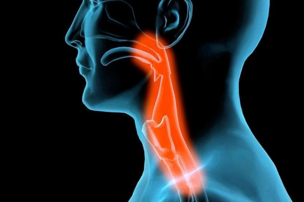 嗓子痛怎么办？5个方法帮你解决到疼痛感