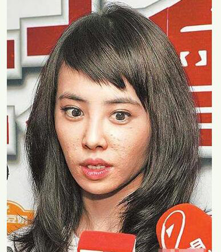 中国卸妆后最丑女明星烂脸爆痘照