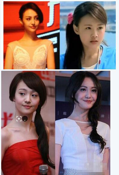 整容失败的明星谁最惨