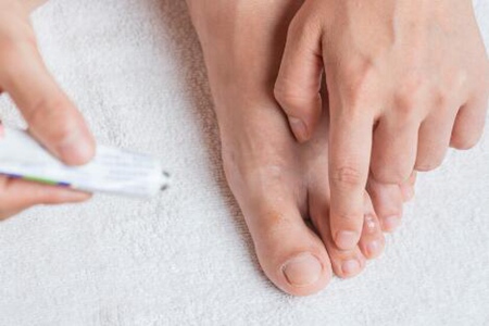 有脚气怎么办快速解决?这五个治疗方法解决脚困扰