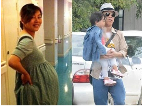 黄渤老婆脸上是啥