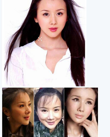 整容失败的明星谁最惨