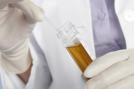 尿急尿频尿不尽是什么原因？这四个疾病原因造成的需重视