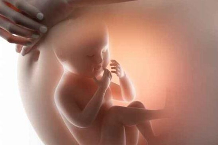 顺产好还是剖腹产好，孕妇生产前要做好哪些准备？