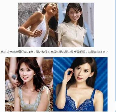 女星为什么要隆胸 盘点女星隆胸前后对比照片图