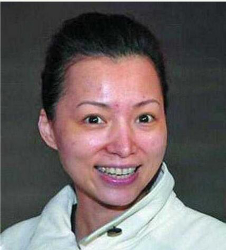 中国卸妆后最丑女明星烂脸爆痘照