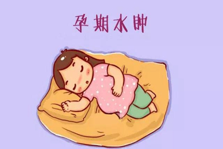 孕期水肿怎么办?这些方法教你快速缓解和预防孕期水肿