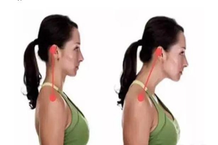 女性如何消除富贵包？这五种方法轻松消除富贵包！