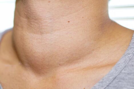 睡觉出汗是什么原因?这五个症状最好警惕起来