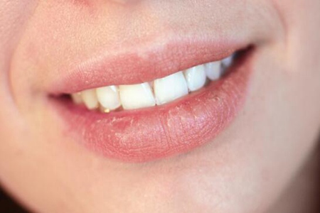 唇炎的症状有哪些?这五个因素及时改善治疗