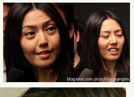 中国卸妆后最丑女明星烂脸爆痘照