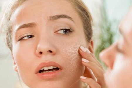 脸上起皮和白色碎屑怎么办?这四个改善方法简单又实用