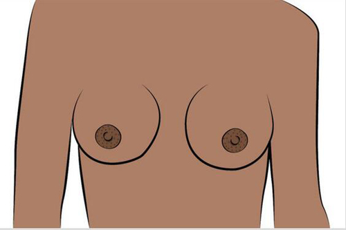 乳头形状有几种图片