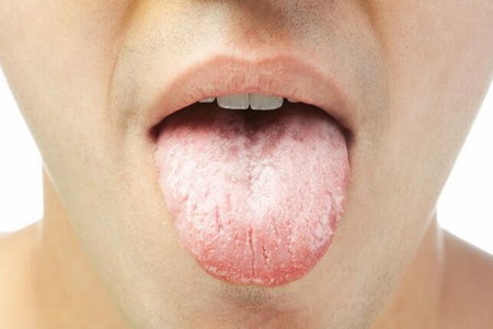 舌头边缘有齿痕是什么原因?这三个女性舌头两侧有齿痕原因