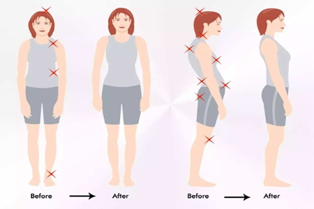 女性生活中完美腿型的八大杀手,你感觉中了几个?