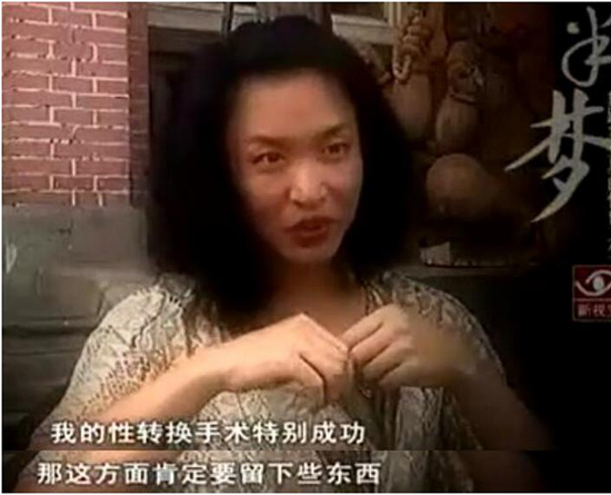 金星为什么要变性手术男变女过程