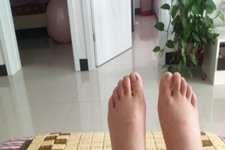 揭秘孕期水肿形成原因,三种方法有效改善情况