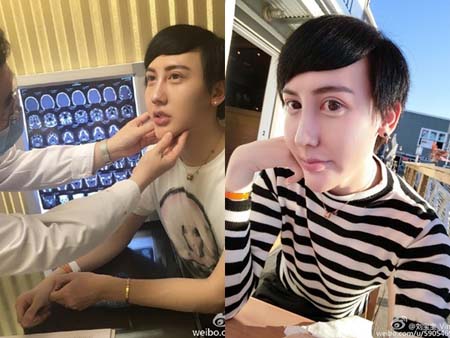 蛇精男找医生鉴定未整容 蛇精男整容前照片曝光
