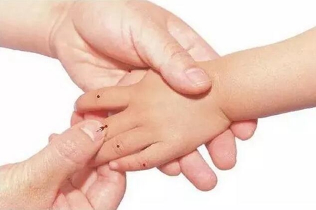 孩子咳嗽痰多不停，家长可以用推拿能缓解