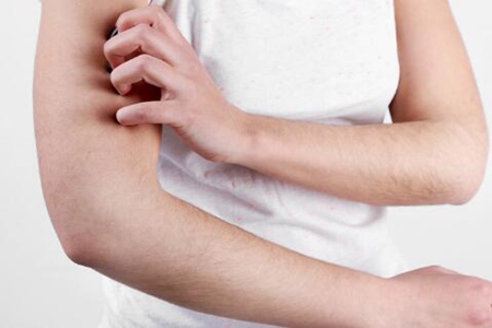 全身发痒是怎么回事?这四个因素造成要及时治疗